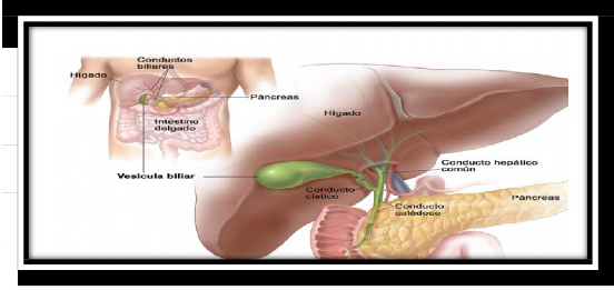 vesícula biliar en bolsa de hartmann