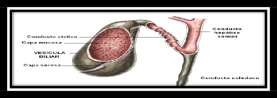 vesícula biliar en bolsa de hartmann