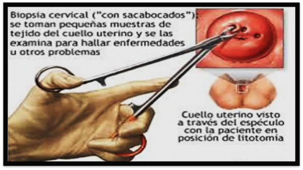 Vista De Cuidados De Las Pacientes Sometidas A Cirugias De Cancer Uterino Reciamuc